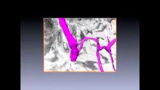 Anchoring structure of the calvarial periosteum revealed by focused ion beam/scanning electron