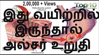 இது வயிற்றில் இருந்தால் அல்சர் உறுதி | Ulcer reason in Tamil | Ulcer cure in Tamil