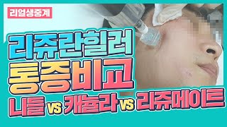 Rejuran with no pain?😎Needle vs Cannula vs Rejumate pain, embossing comparison[Real Procedure Vid]