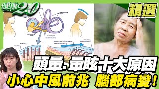 頭暈.暈眩勿輕忽！小心中風前兆 腦部病變！3招自我檢測【健康2.0精選】