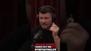 Michael Bisping Takes Out His Eye
