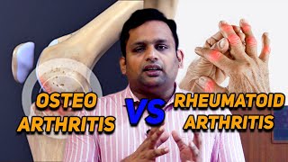 Osteoarthritis Vs Rheumatoid Arthritis|Dr. Shriram Krishnamoorthy