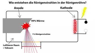 Wie entstehen die Röntgenstrahlen in der Röntgenröhre?