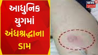 Junagadh News : આધુનિક યુગમાં અંધશ્રદ્ધાના ડામ | Crime News | Keshod | Superstitions |Gujarati News