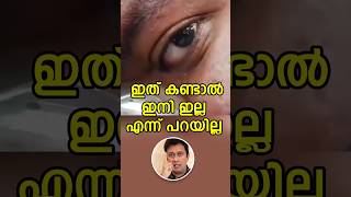 ഇത് കണ്ടാൽ ഇനി ഇല്ല എന്ന് പറയില്ല Watch This And All Your Worries Will Vanish - Malayalam Motivation