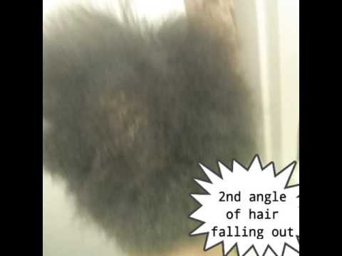 Fluocinonide! The fastest hair growing steroid! Fluocinonide! The fastest hair growing steroid!