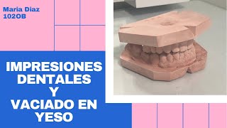 Toma de impresiones dentales y vaciado de yeso. María Díaz 102OB