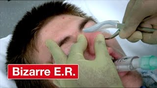 Resetting A Broken Nose - Bizarre ER