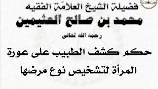 ابن العثيمين  -  حكم كشف الطبيب على عورة المرأة لتشخيص نوع مرضها