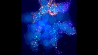 BPPB Virtual Seminar, Fangyuan Ding, “Constitutive splicing + economies of scale in gene expression”