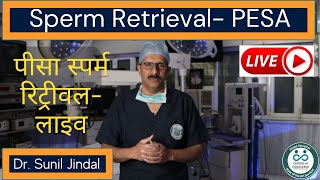 Sperm Retrieval PESA Live|पीसा स्पर्म रिट्रीवल- लाइव|Dr. Sunil Jindal|Jindal Hospital Meerut