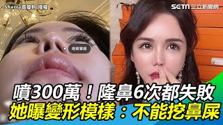 噴300萬！隆鼻6次都失敗 她曝變形模樣：不能挖鼻屎｜三立新聞網 SETN.com