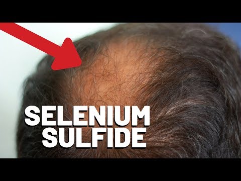 Does Selenium sulfide change hair color?