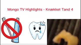 Mongo TV Highlights - Knækket Tand 4