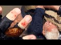 Jeremy Wade Bitten Hard By Catfish | CATFISH | River Monsters