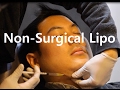 Non-surgical Liposuction Fat Dissolving Injections In Korea | Seoul Guide Medical