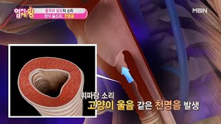 충격과 공포의 숨소리, 천식 숨소리 ＜천명음＞