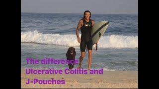 Ulcerative Colitis vs J-pouch PROS vs CONS