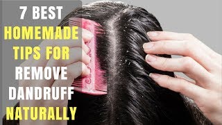 7 BEST HOMEMADE TIPS FOR REMOVE DANDRUFF NATURALLY | Health Benefits in English