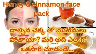 Diy face pack for pimples|| మొటిమల కోసం మంచి ఫేస్ ప్యాక్||honey cinnamon pack||episode- 23