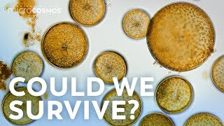 What If All the Microbes Disappeared?