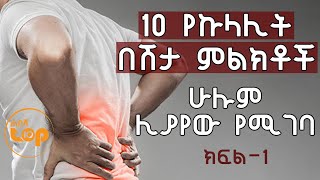 10 የኩላሊት በሽታ ምልክቶች ክፍል-1 | 10 Signs You May Have Kidney Disease | Ethiopia