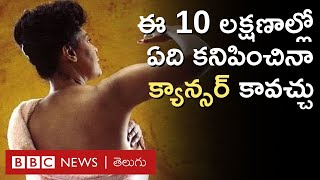 Cancer: మనం పట్టించుకోని 10 క్యాన్సర్ లక్షణాలు, వీటిలో ఏది కనిపించినా నిర్లక్ష్యం చేయకండి BBC Telugu