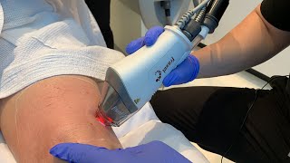 Fraxel to the Knees | Laser Skin Tightening Treatment | West Hollywood, CA | Dr. Jason Emer