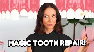 What is Tooth Bonding? (Magic?)