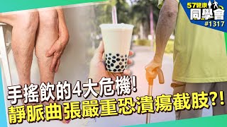 手搖飲的4大危機！靜脈曲張嚴重恐潰瘍截肢？！【57健康同學會】｜隋安德 許晶晶 甘宗本 李婉萍 洪素卿 Paul