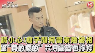 請小心!瘦子聞柯震東險破相驚「真的假的」 六月露營也慘摔｜TVBS娛樂頭條@tvbsforfun