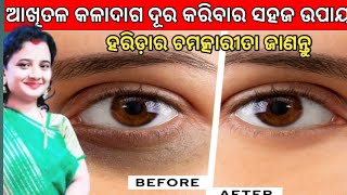 ଆଖି ତଳ କଳାଦାଗ ଦୂର କରିବାର ସହଜ ଉପାୟ | ହରିଡ଼ାର ଚମତ୍କାରୀତା ଜାଣନ୍ତୁ |