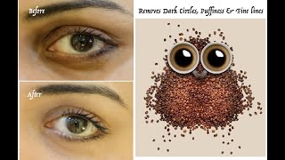 Magic under eye cream for late night owls | 99.9% effective against dark circles