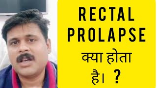 मलद्वार बहार आना (Rectal Prolapse | Rectopexy )