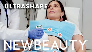 How UltraShape Destroys Fat For Good | Between The Before \u0026 After | NewBeauty