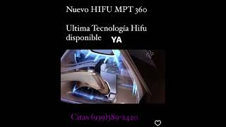 Nuevo Hifu MPT  360 Face Lifting