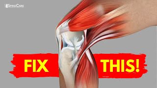 How to Fix Knee Pain for Good (AT HOME!)