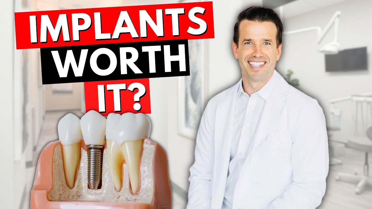 Dental Implants - Options For Missing Teeth - YouTube