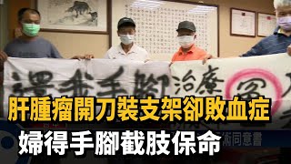 肝腫瘤開刀裝支架卻敗血症 婦得手腳截肢保命－民視新聞