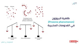 Prozone phenomenon l  تأثير ظاهرة بروزن في الفحوصات المخبرية