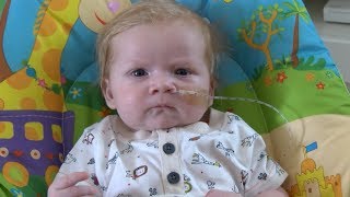 12-week-old battles rare and potentially fatal condition