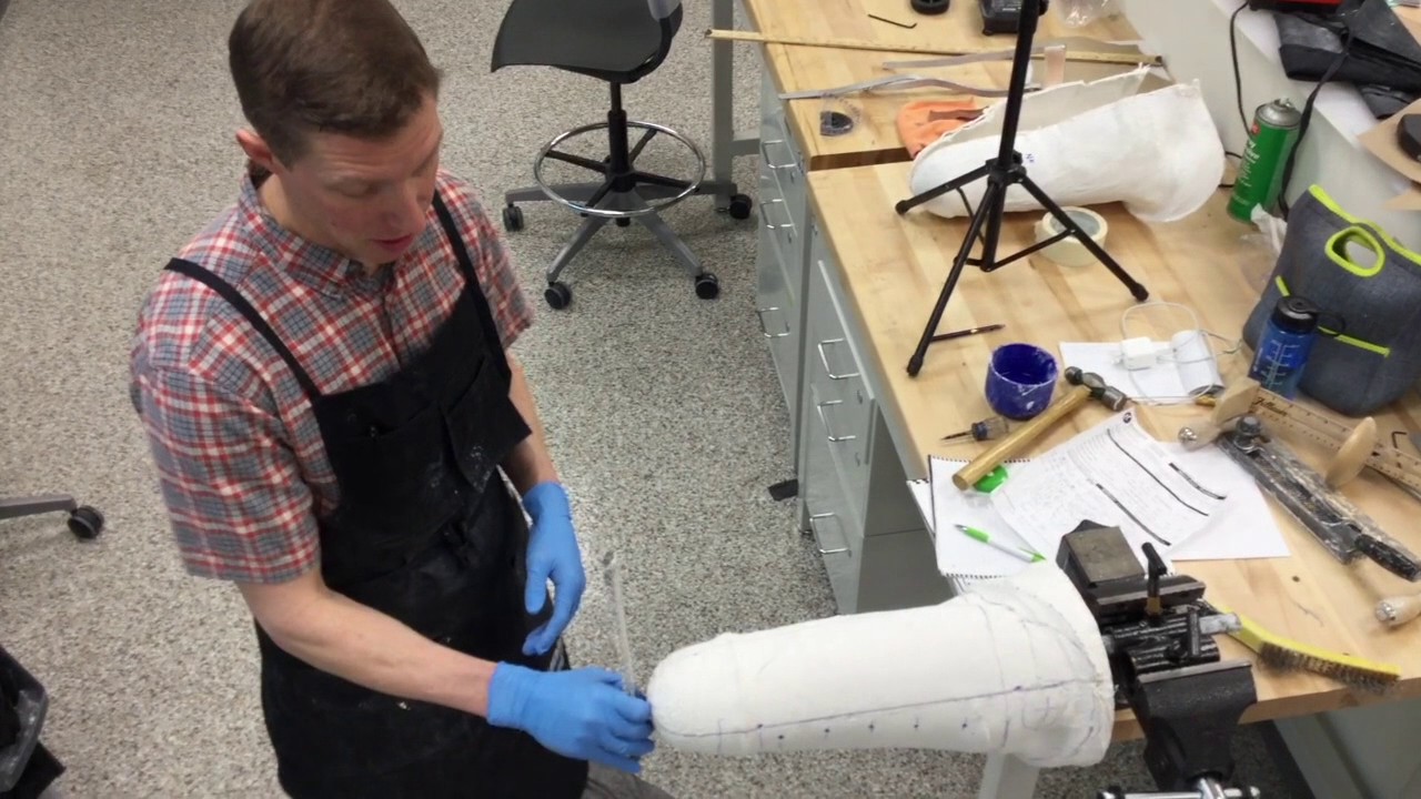 Transfemoral Cast Modification Part 1 Youtube