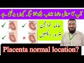 Placenta Anterior | Posterior| placenta location | Dr Qazi Fahim Shezad