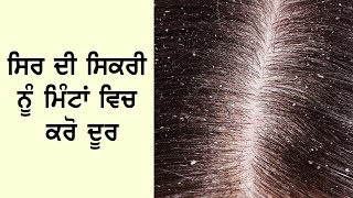 ਸਿਰ ਦੀ ਸਿਕਰੀ ਦਾ ਇਲਾਜ ਮਿੰਟਾ ਚ ਕਰੋ ll Dandruff Treatment at Home For Men and Women in Punjabi