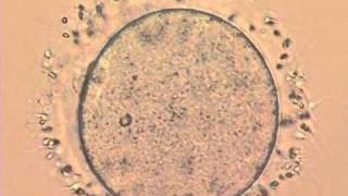IVF Sperm trying to penetrate an egg