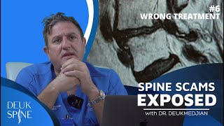 Common misdiagnose of Back Pain. (EP.6 Spine Scams)