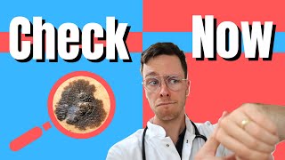 How to do a skin cancer CHECK! - Medical Doctor Explains