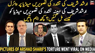 How did media get the pictures of Arshad Sharif's alleged torture?