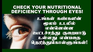 கண்களின் மூலம் உடலில் உள்ள ஊட்டச்சத்து குறைபாட்டை தெரிந்துகொள்ளுங்கள்! Nutritional deficiency!