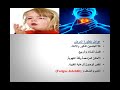 مرض الخناق أسبابه والعلاج وطرق الوقاية منه